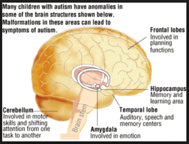 Causes of Autism: Genetic, Environmental or Both? | Autism Wing